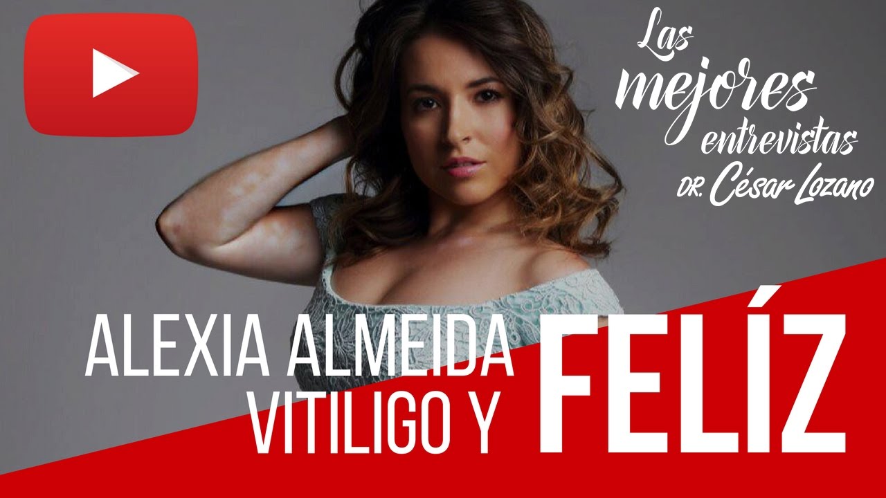 &iexcl;Vitiligo y Fel&iacute;z! - Entrevista con Alexia Almeida - Dr. C&eacute;sar Lozano