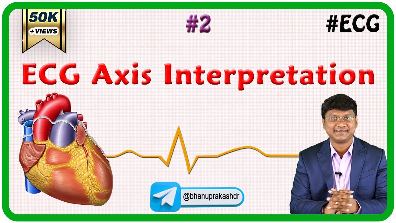 2. ECG Axis Interpretation - ECG assessment and ECG interpretation made easy