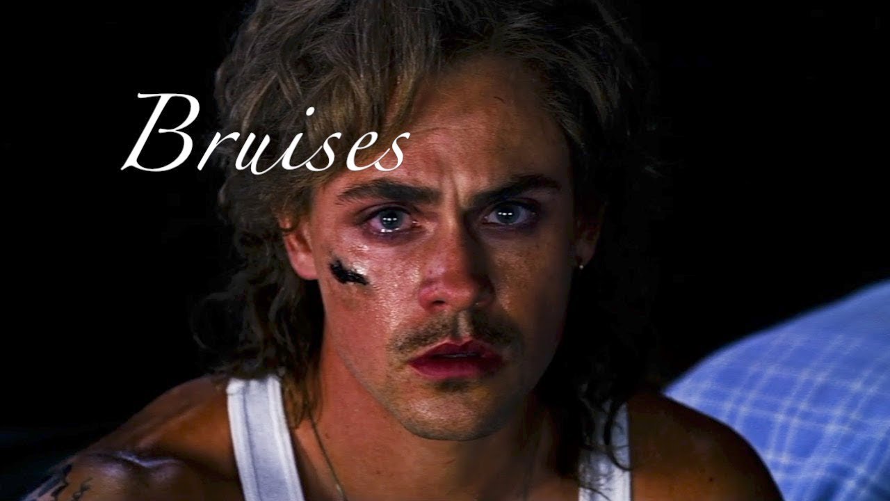 Billy Hargrove│Bruises