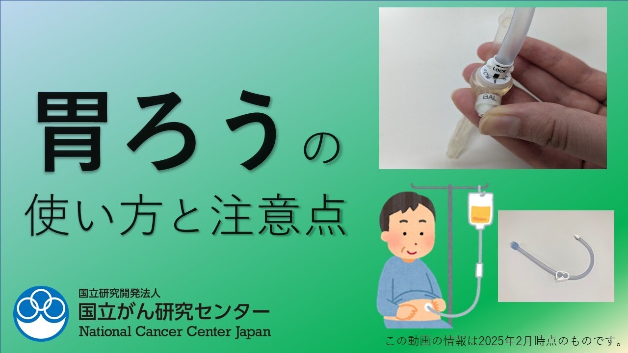 胃ろうの使い方と注意点【国立がん研究センター 東病院】