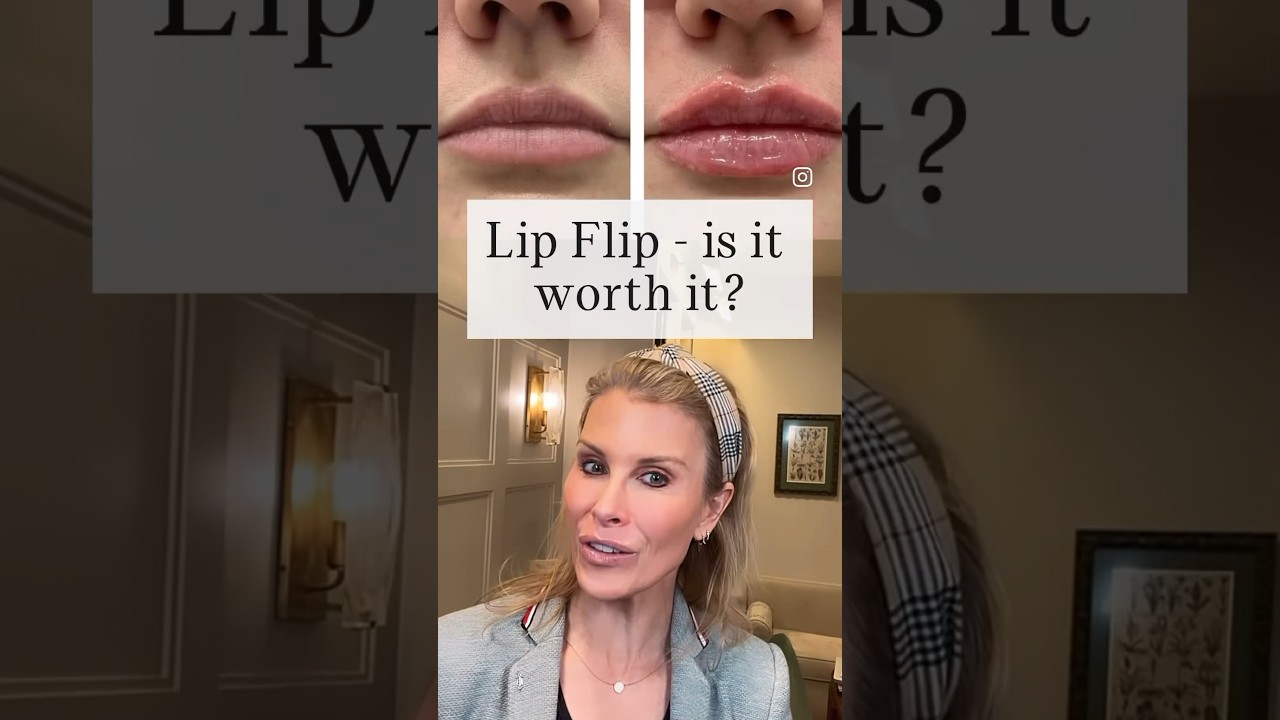 Стоит ли делать Lip Flip? #ботокс #красота #филлер