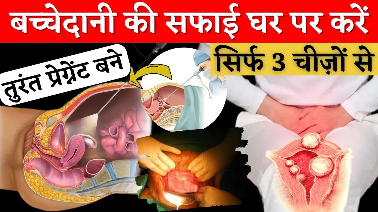 बच्चेदानी की सफाई घर पर करें 😱 सिर्फ 3 चीज़ों से, तुरंत प्रेग्नेंट बने - Uterus Cleaning Tips