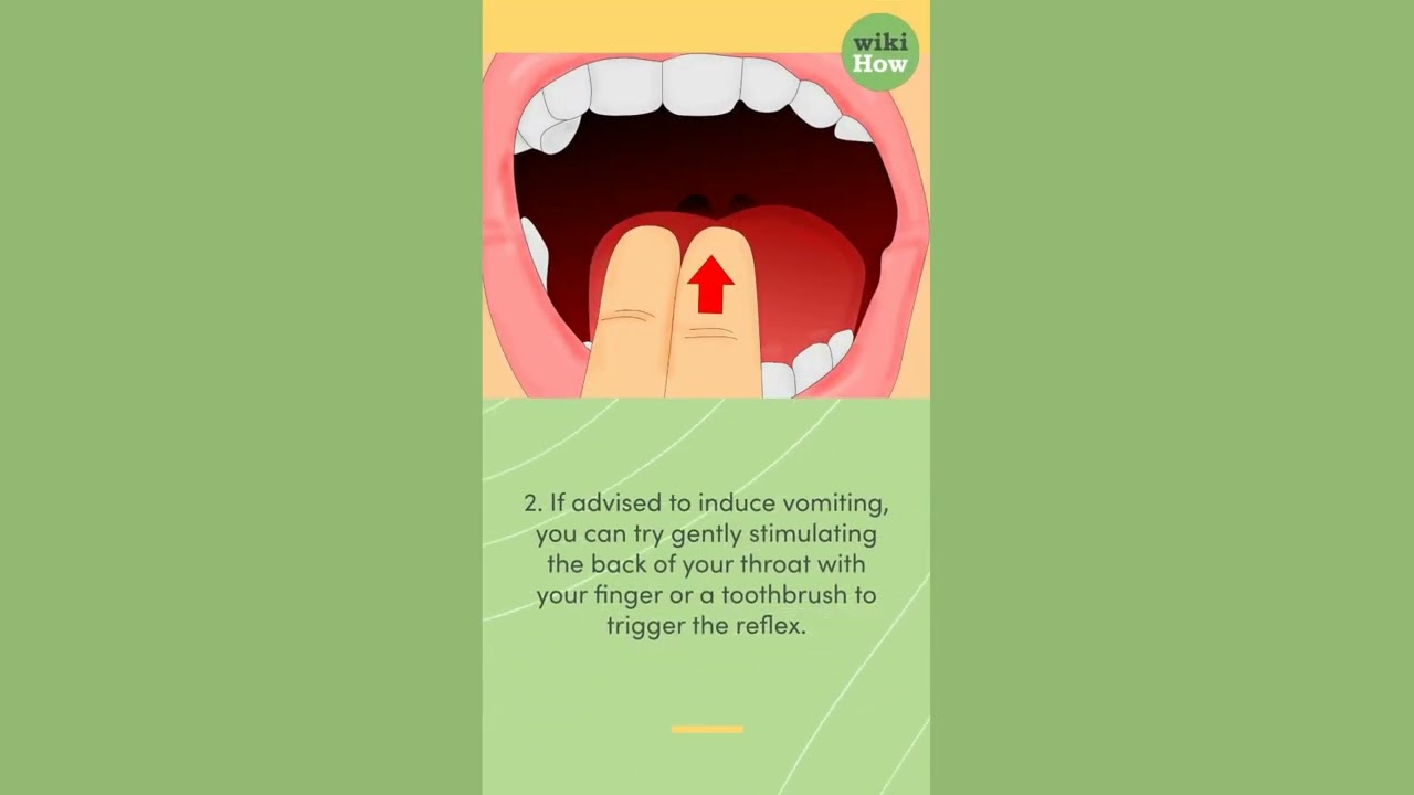 How To Induce Vomiting