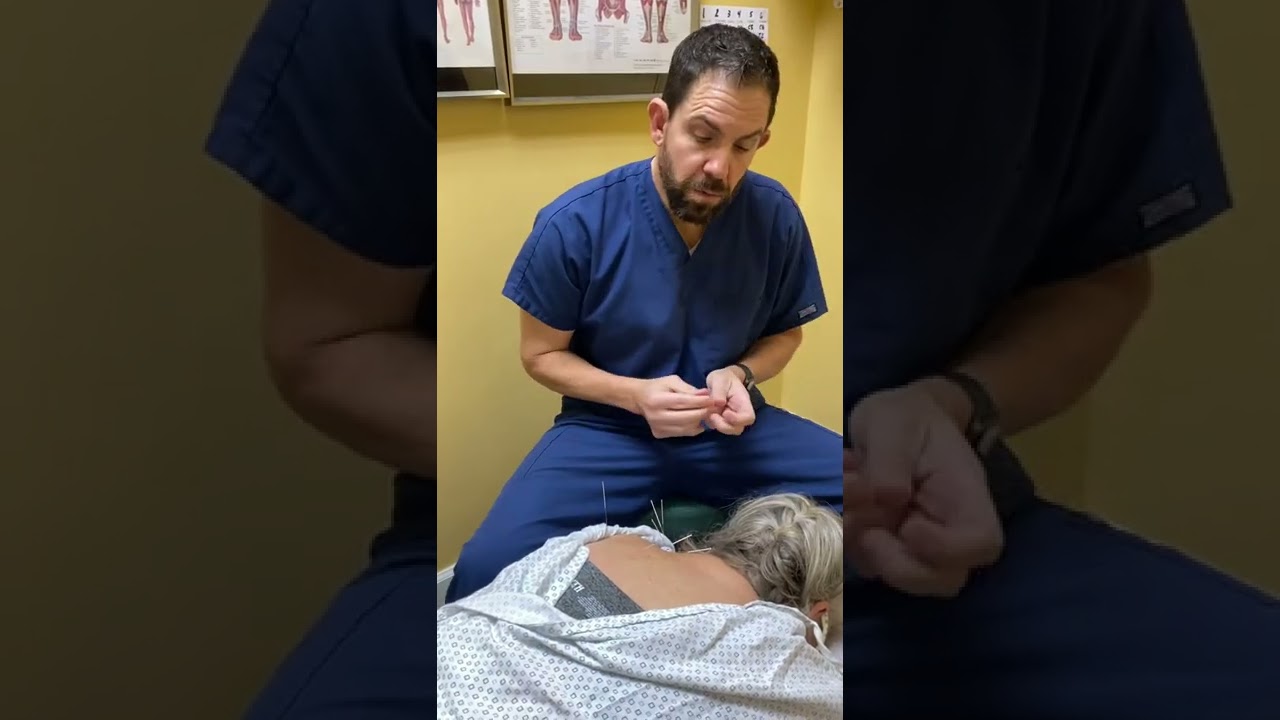 Shoulder pain and dry needling