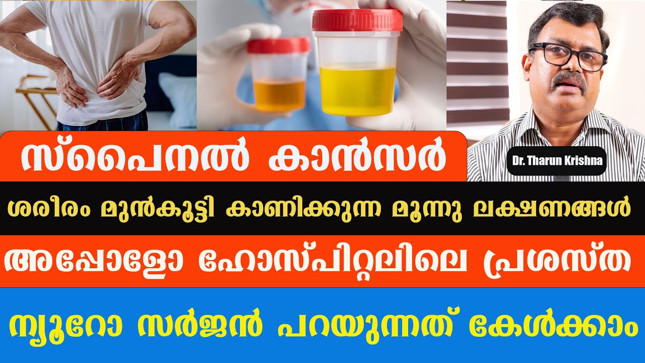 സ്‌പൈനൽ കാൻസർ ശരീരം മുൻകൂട്ടി കാണിക്കുന്ന മൂന്നു ലക്ഷണങ്ങൾ /Dr. Tharun Krishna