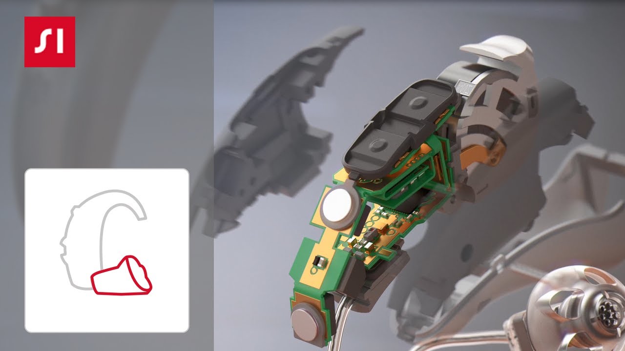 Wie sieht ein H&ouml;rger&auml;t von innen aus?