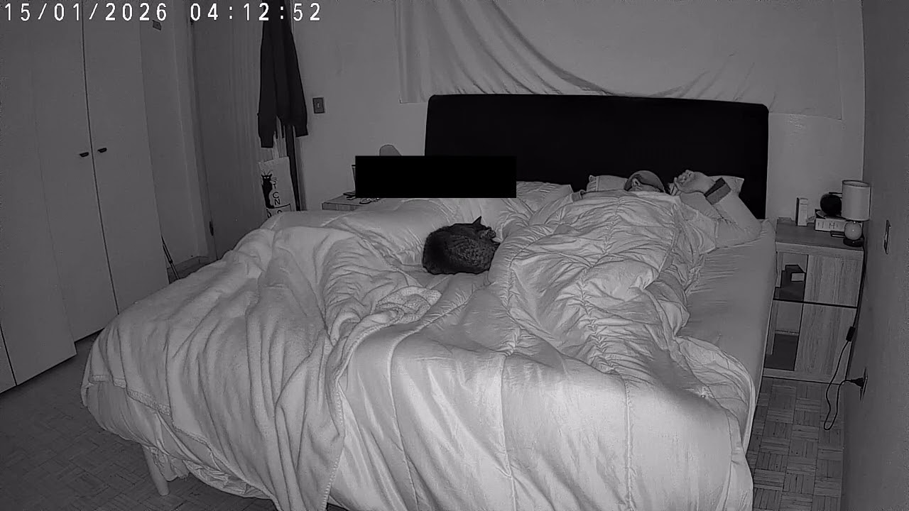 Probable Nightly Focal Epilepsy: legs and chest movement (15/1/2026) #2