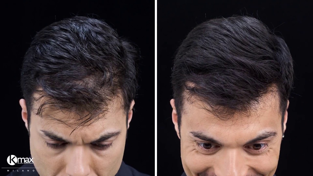 Kmax Tutorial - John shows us how to makeup and disguise thinning hair with Kmax Hair Fibers