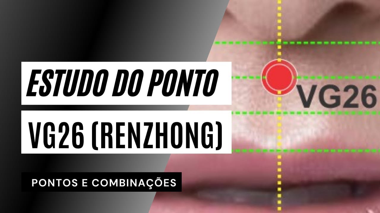 VG26 (renzhong) - Estudo do Ponto