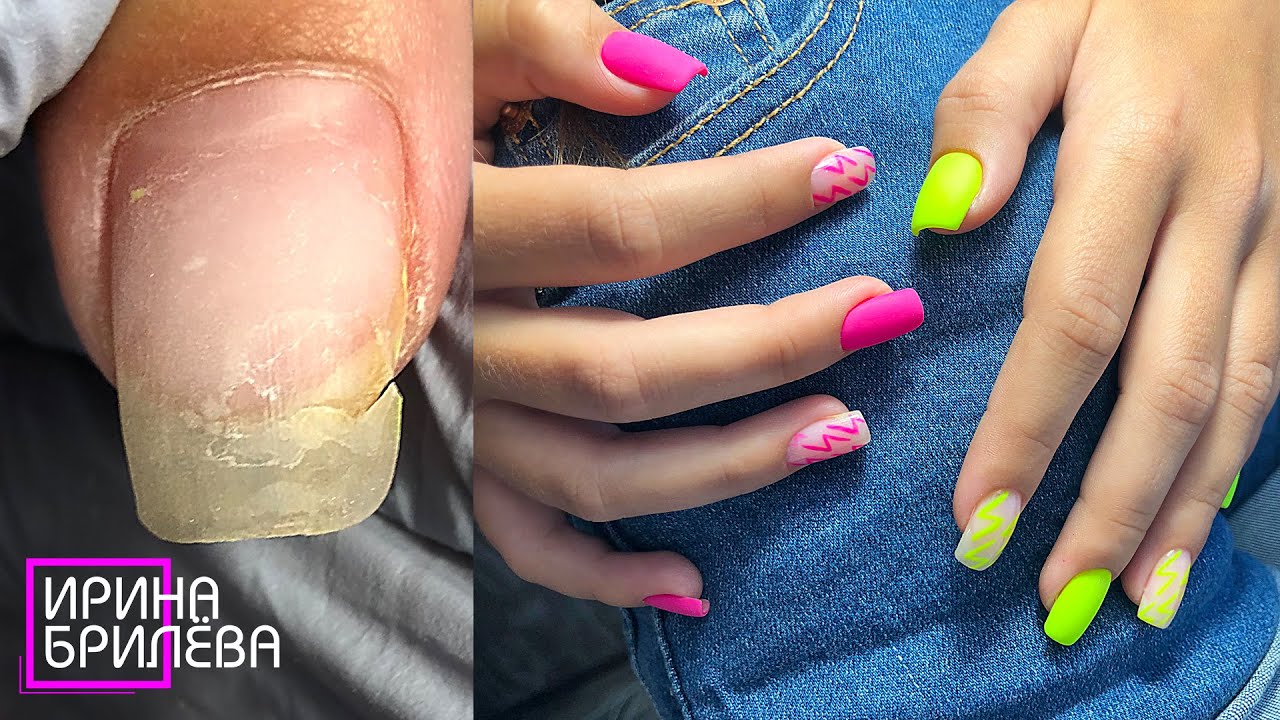 ДЕТСКИЙ маникюр 😍 РЕМОНТ сломанного ногтя