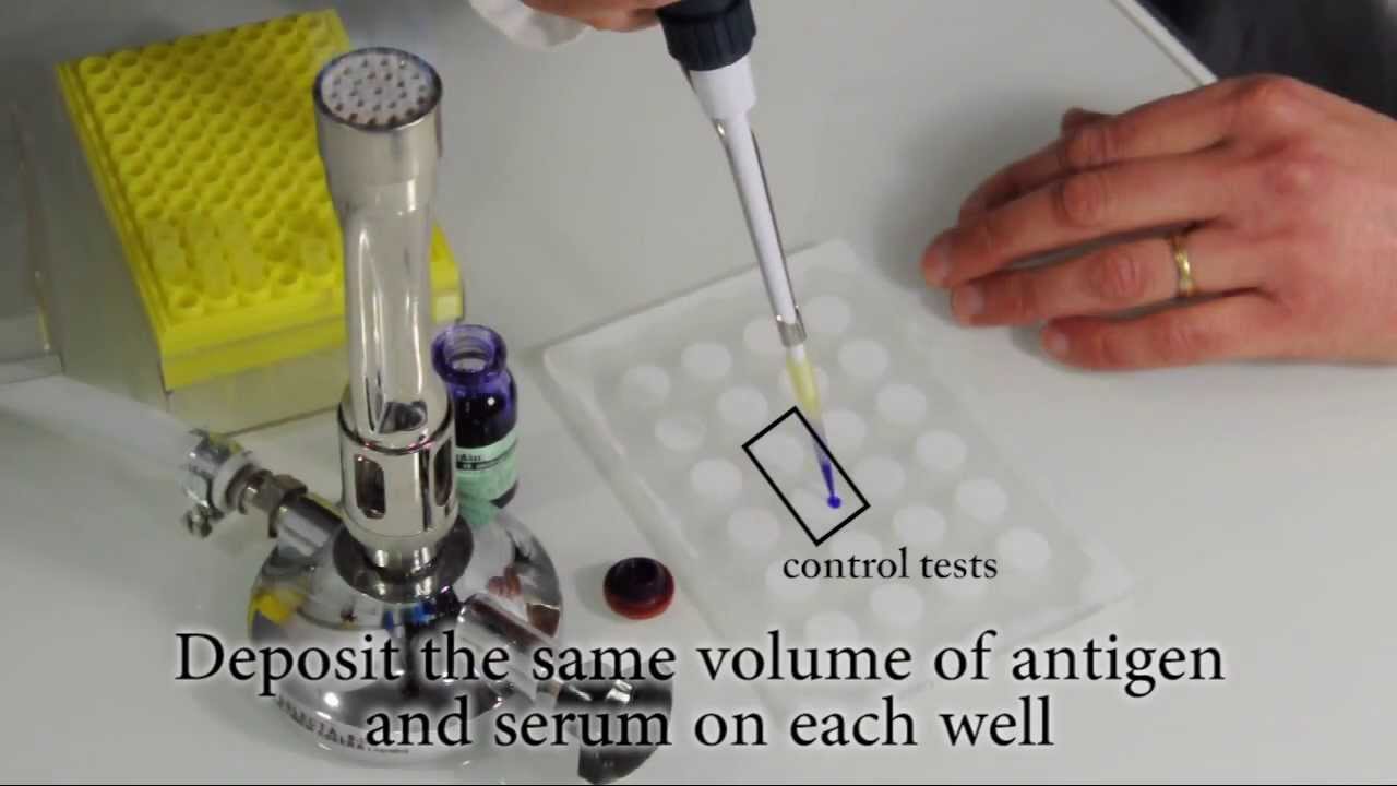 How to perform a Rapid Slide Agglutination Test