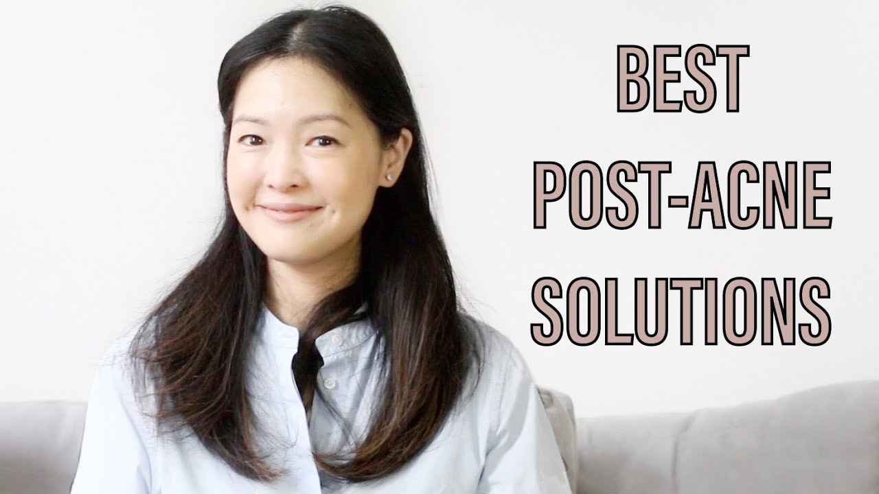 Best Post-Acne Treatments for Red Marks + Bumpy Skin | PIE