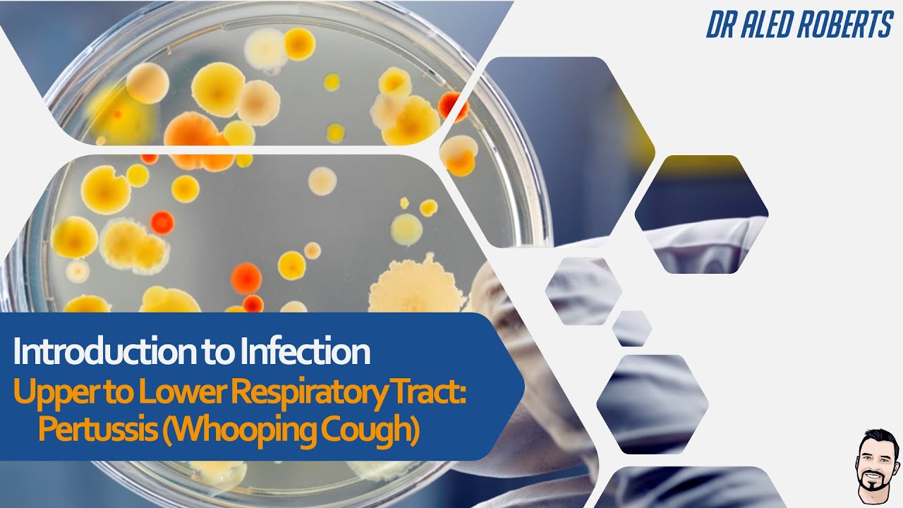 Upper Respiratory Infection, Pertussis (Whooping Cough)