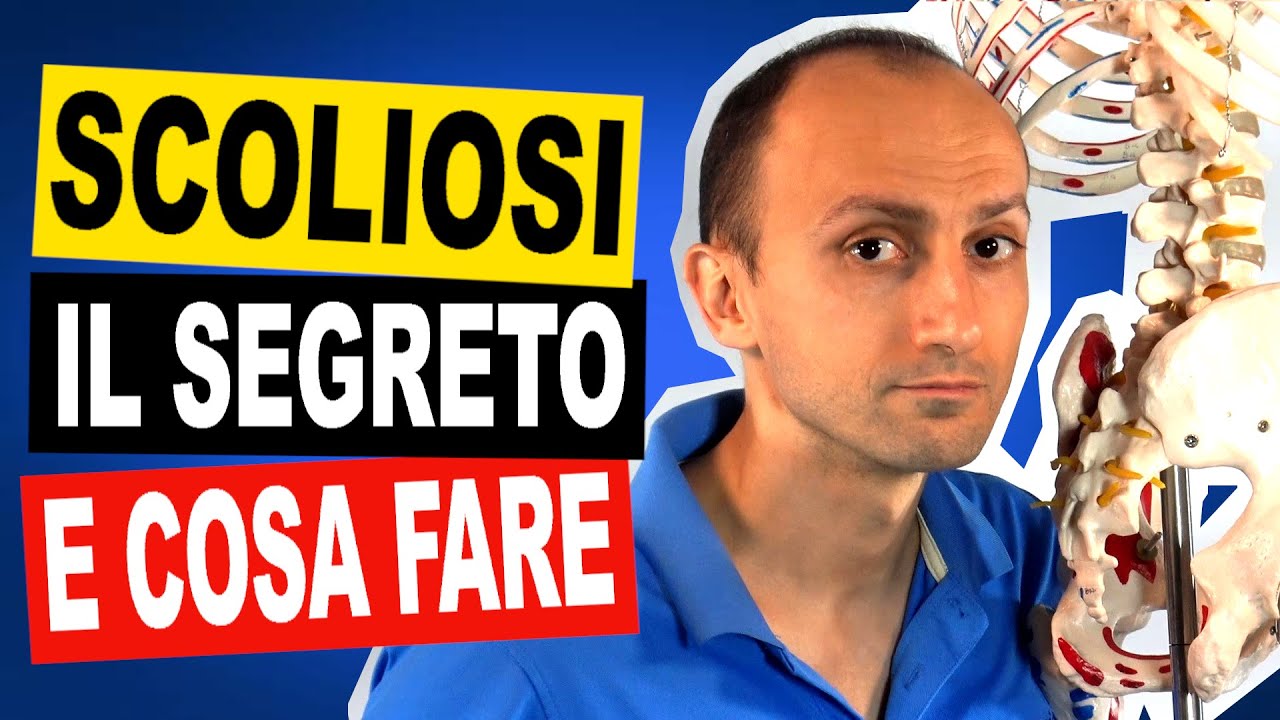 Scoliosi: Scopri le cause e i i Sintomi