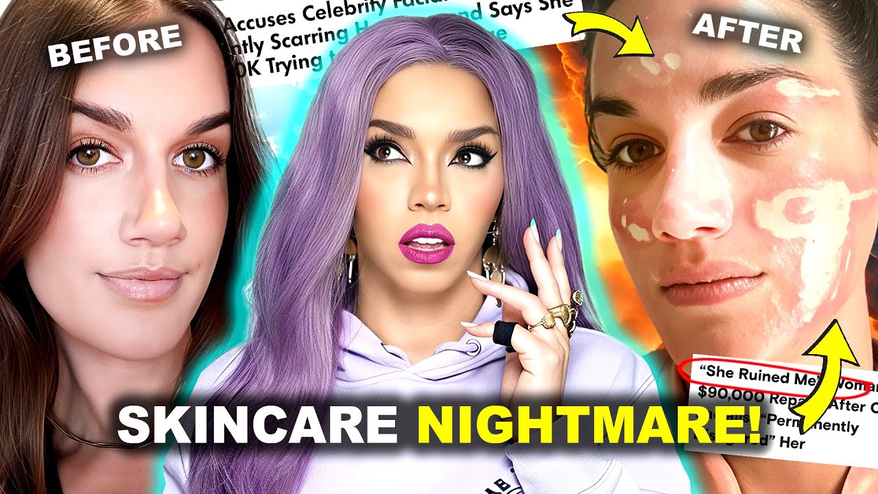Viral TikTok EXPOSES Celebrity Esthetician: ‘She RUINED My Face’ | Influencer Disaster