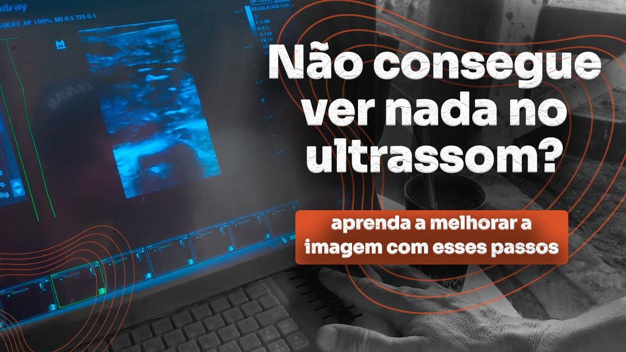 Aprenda a melhorar a imagem, ganho e foco do ultra-som com esses passos.