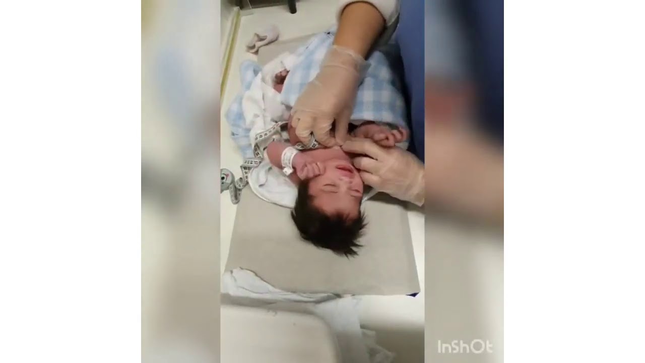 MEDIDAS ANTROPOMÉTRICAS DO RECÉM NASCIDO