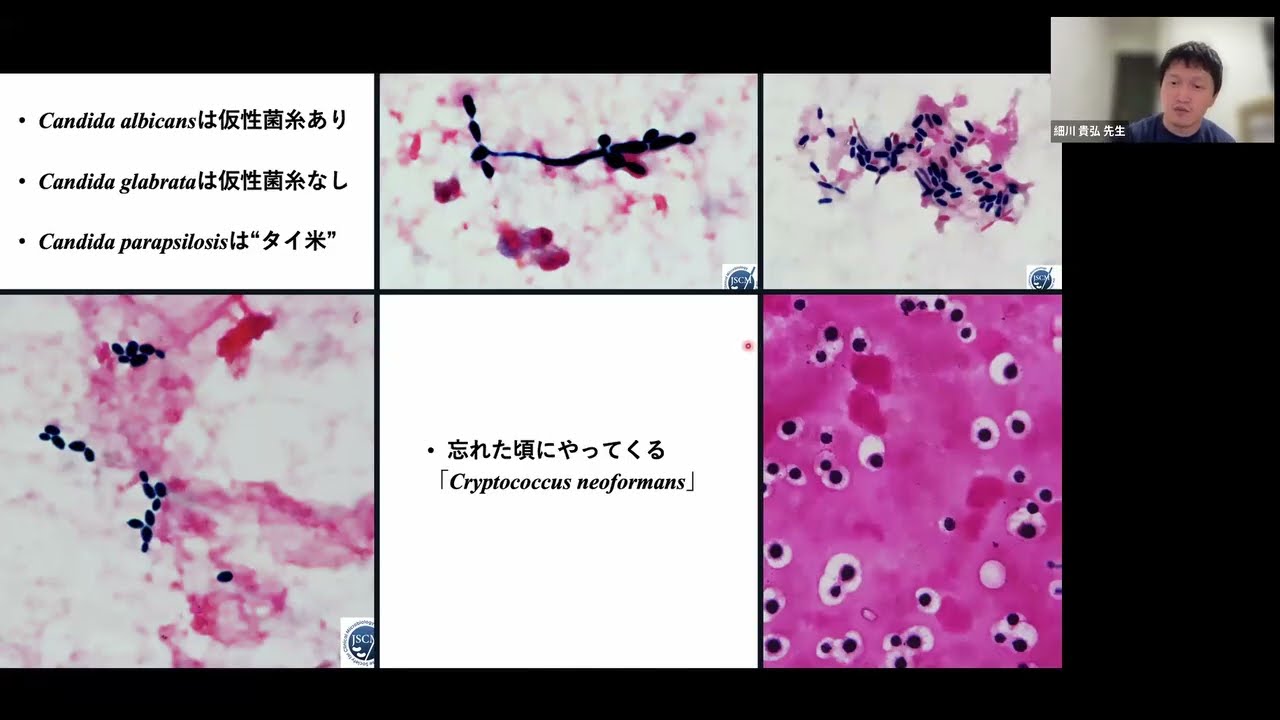 臨床的に重要な微生物⑥カンジダ属（令和7年度 第11回 岐阜感染症セミナー）