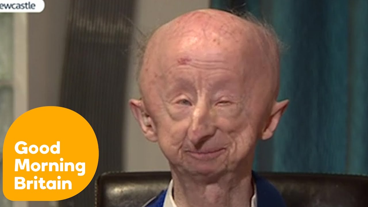 Interview With Mugged Pensioner Alan Barnes | Good Morning Britain