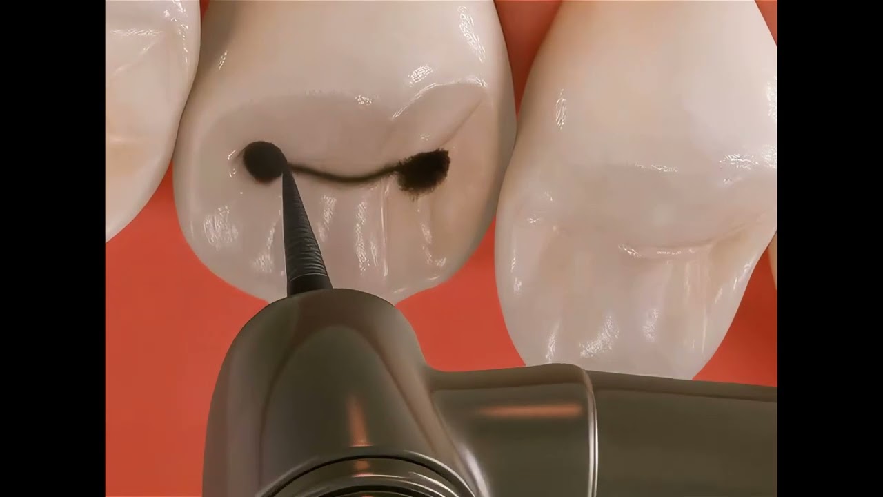 Dental 3D Animation - Make it yourself with our books without any training!
