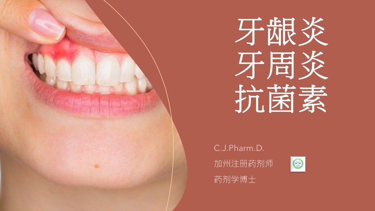 如何预防和治疗牙龈炎和牙周炎。中国治疗牙齿疾病抗生素滥用问题。