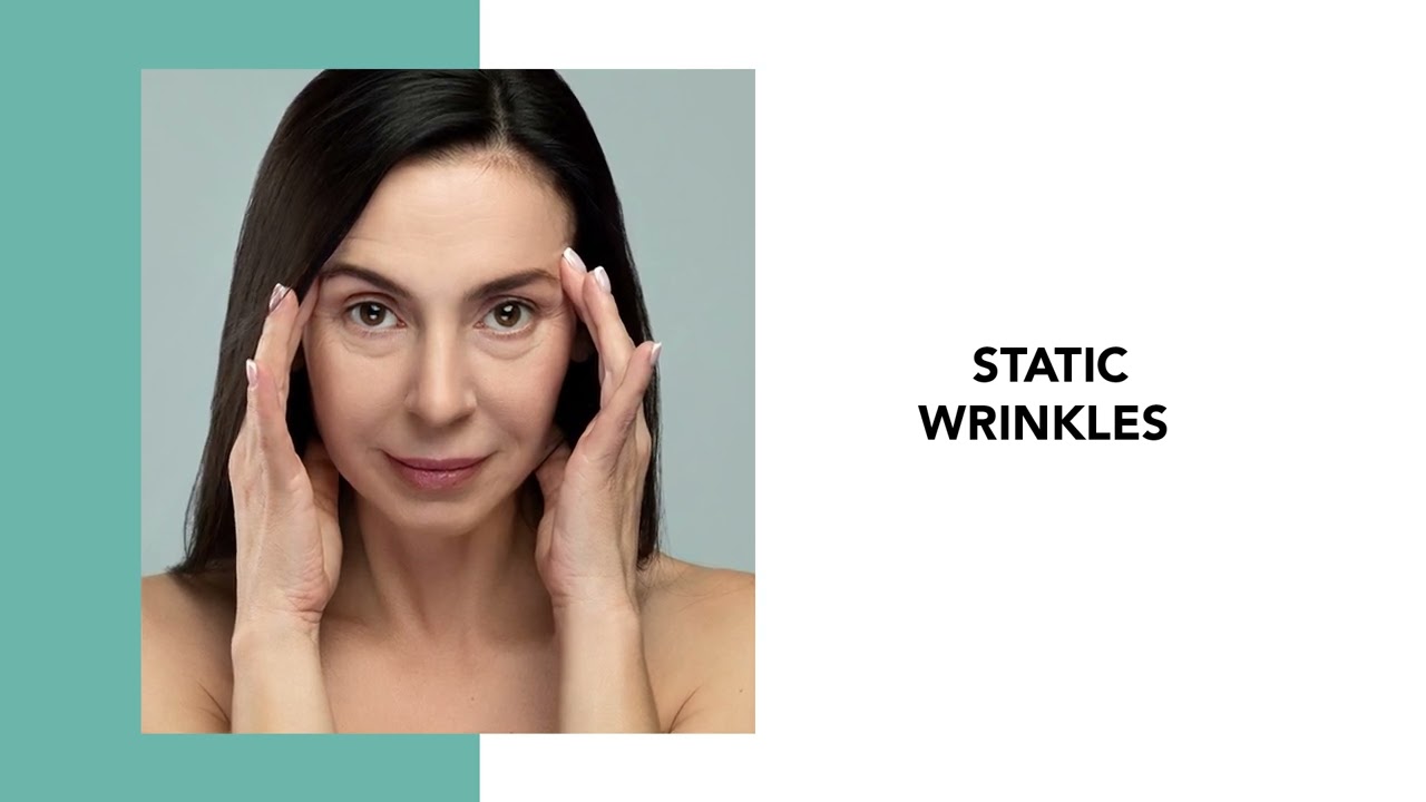 Your Go-to Guide for Wrinkle Types and How to Treat Them