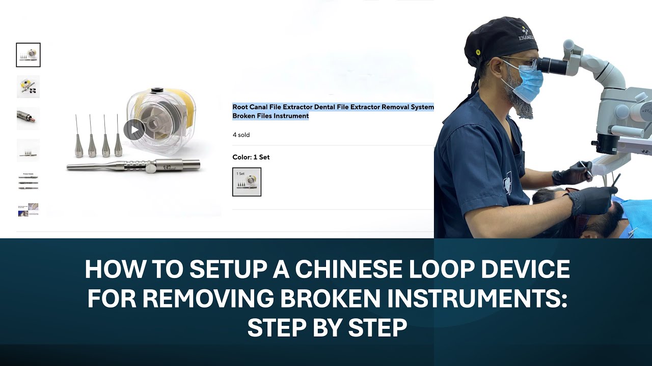 HOW TO SETUP A CHINESE LOOP DEVICE FOR REMOVING BROKEN ENDODONTIC INSTRUMENTS