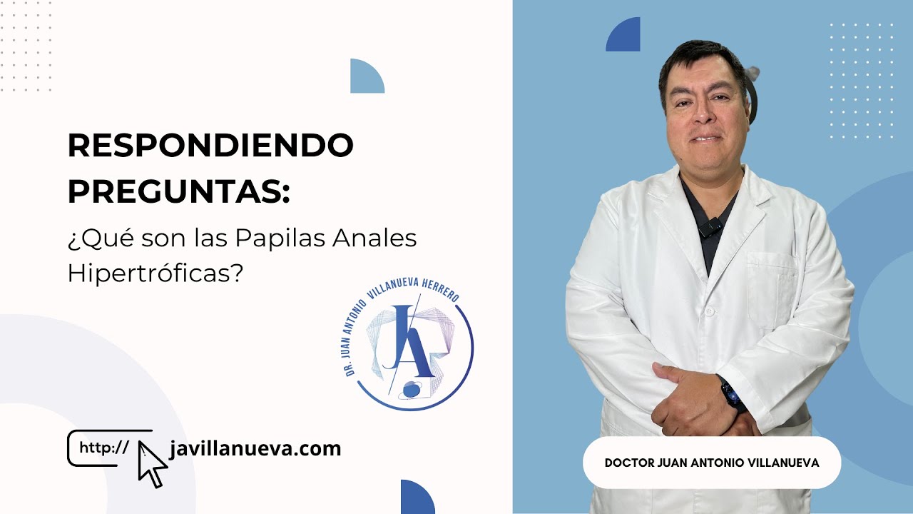 &iquest;Qu&eacute; son las Papilas Anales Hipertr&oacute;ficas?