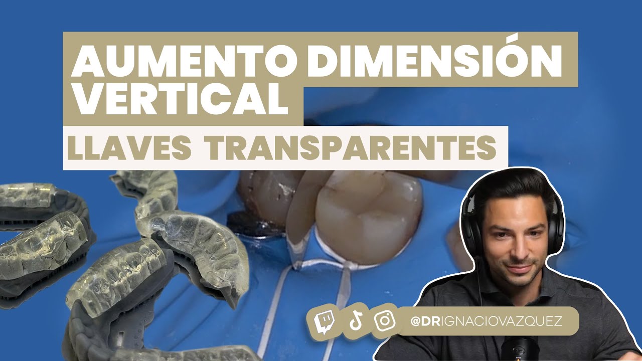 AUMENTO DIMENSIÓN VERTICAL. Estampado con LLAVES TRANSPARENTES