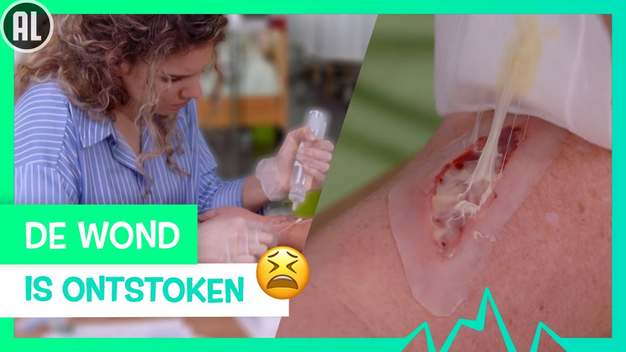 ZO MAAK JE EEN ONTSTOKEN WOND SCHOON! 🧼 | TOPDOKS | SPECIALISME
