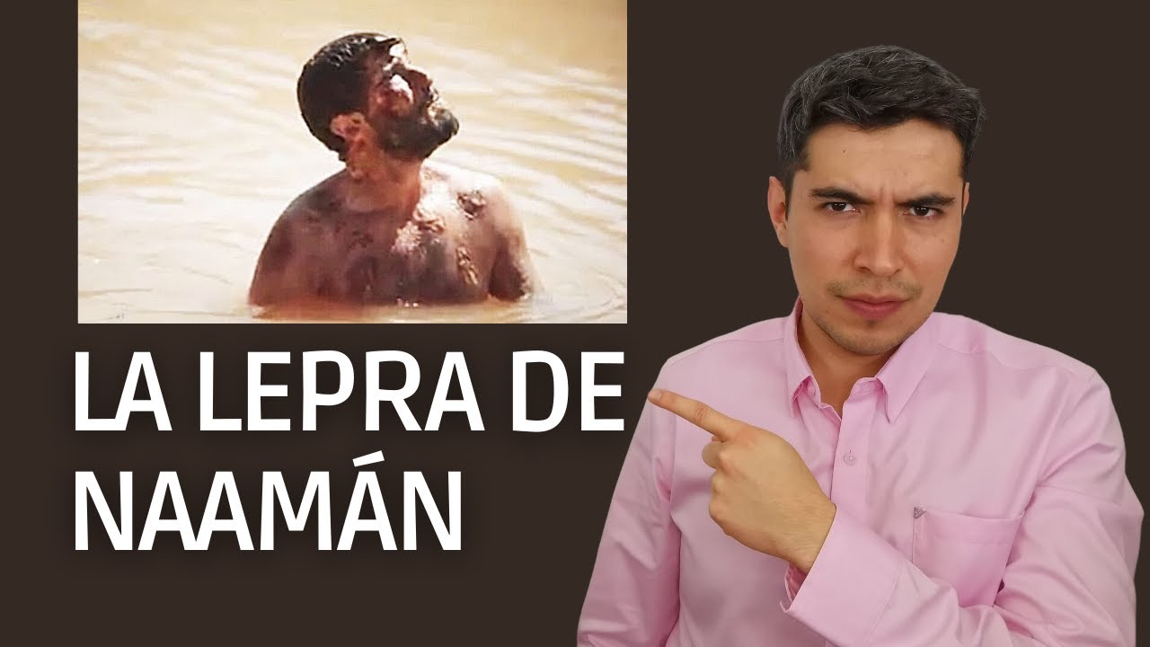 Suelta el orgullo - La lepra de Naamán | Prédicas cristianas | Nicolás Ramos