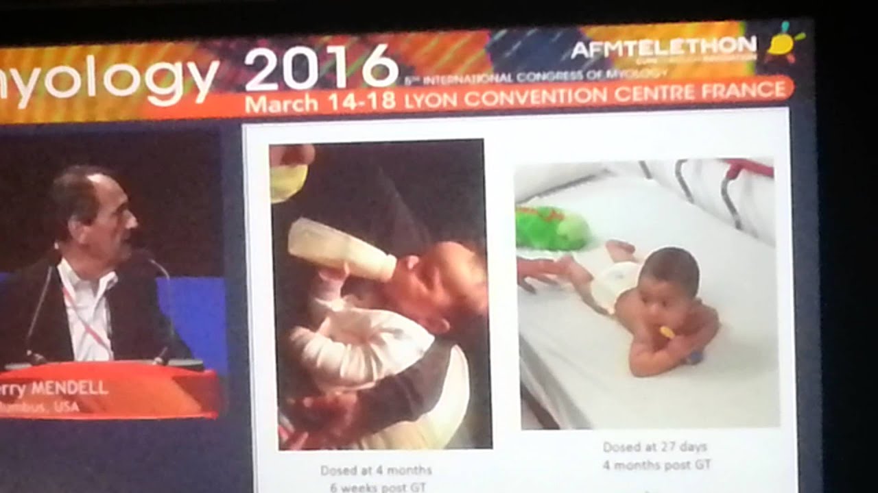 Myologie 2016 - Avexis - AVXS-101 - 1/3 SMA