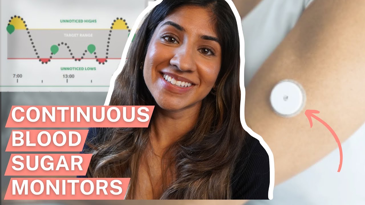 Continuous blood glucose monitors - do we need them?