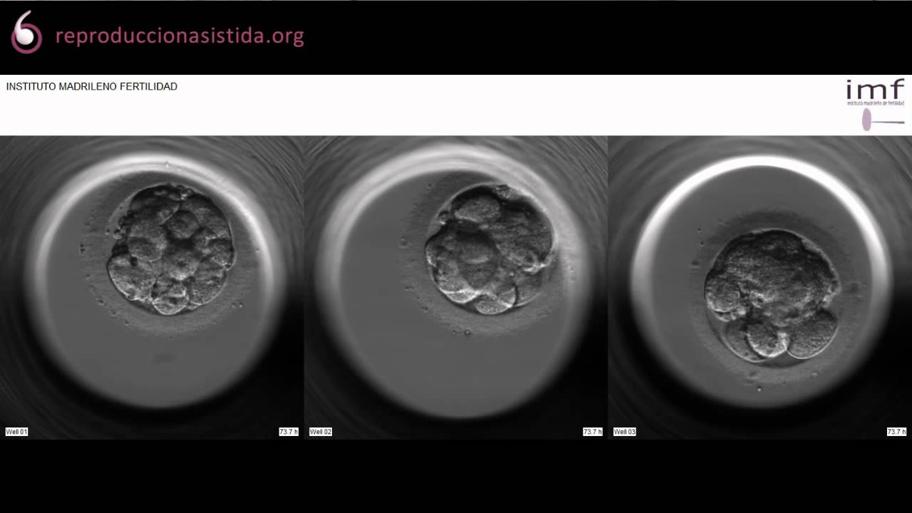 Imágenes de desarrollo del embrión - Embryoscope