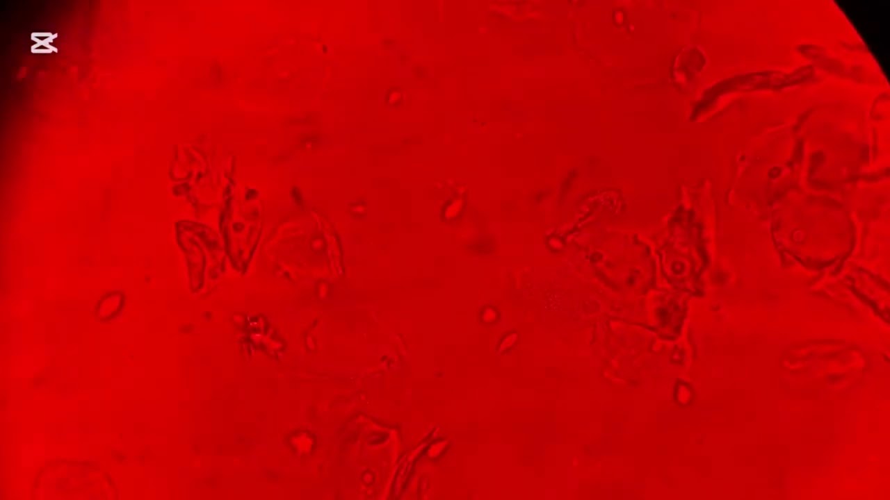 Tout savoir sur le trichomonas urogénitale au microscope#new #foryou