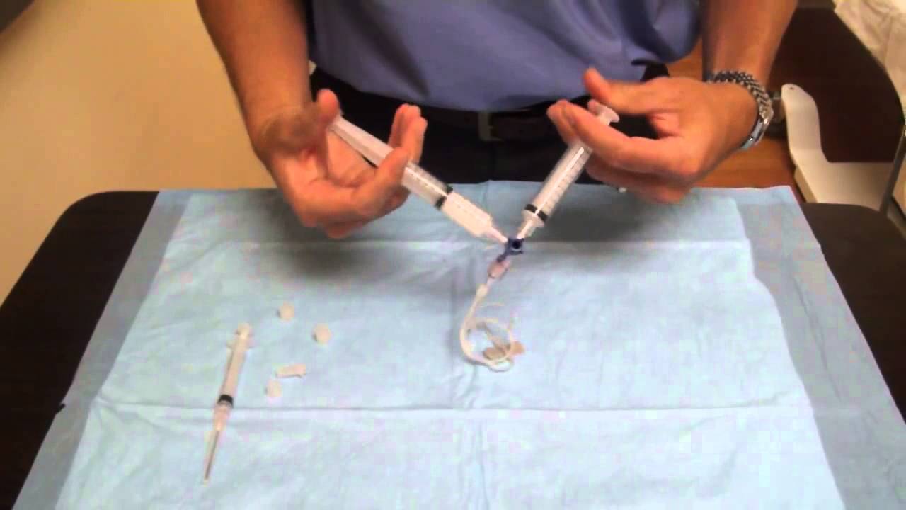 Vein Treatment in Miami, Florida - Foam Sclerotherapy  - (305) 417-8346