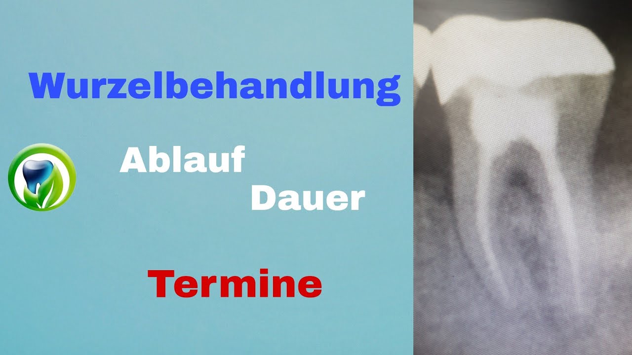 Wurzelbehandlung - Ablauf, Dauer, Termine, wie l&auml;uft sowas ab?