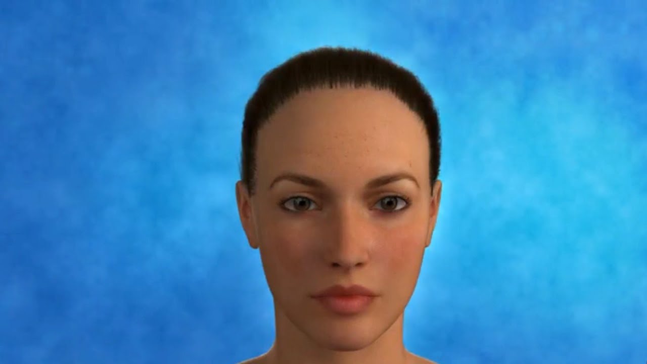 Facelift Full Animation