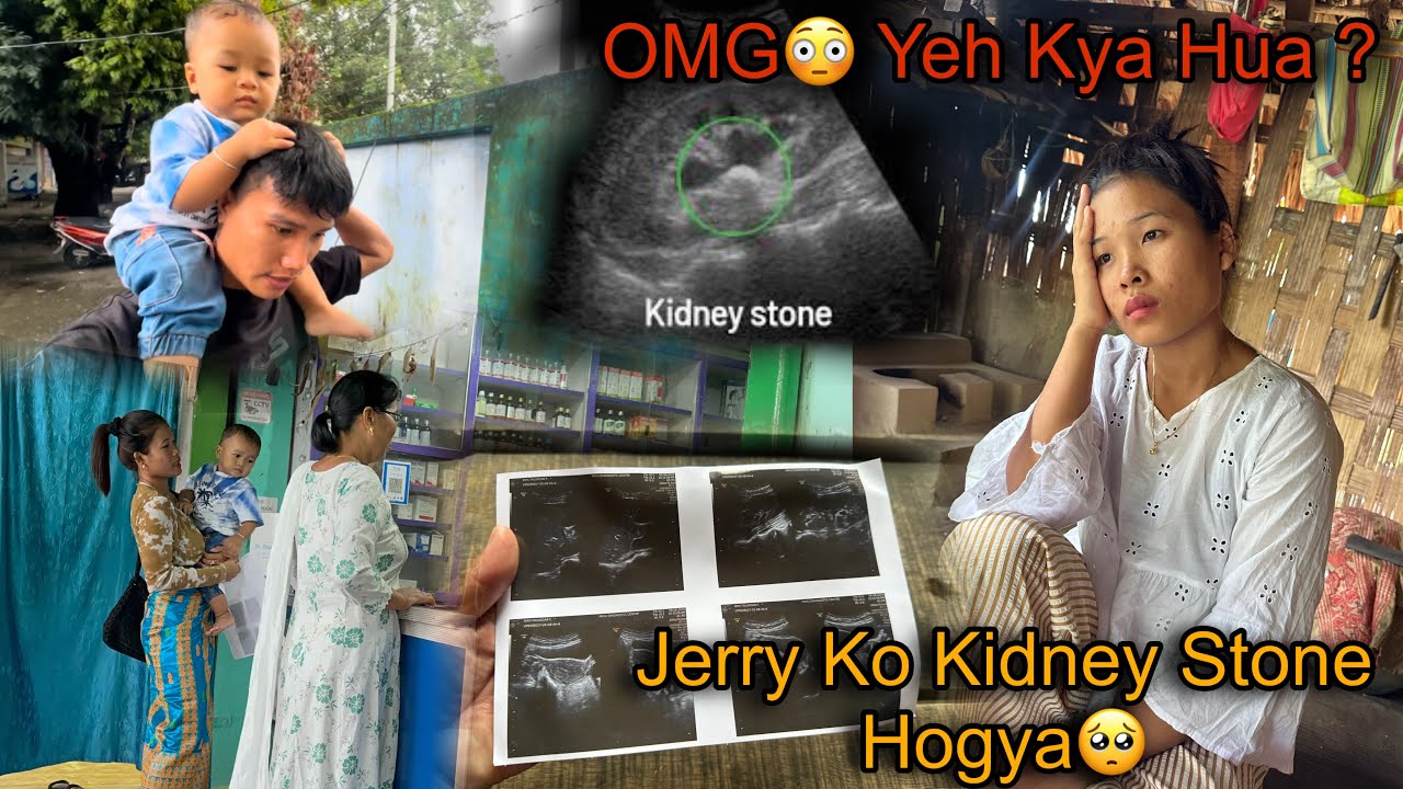 OMG😳 Yeh Kya Hua ? Jerry Ko Hua Kidney Stones🥺 Medical Report ! 