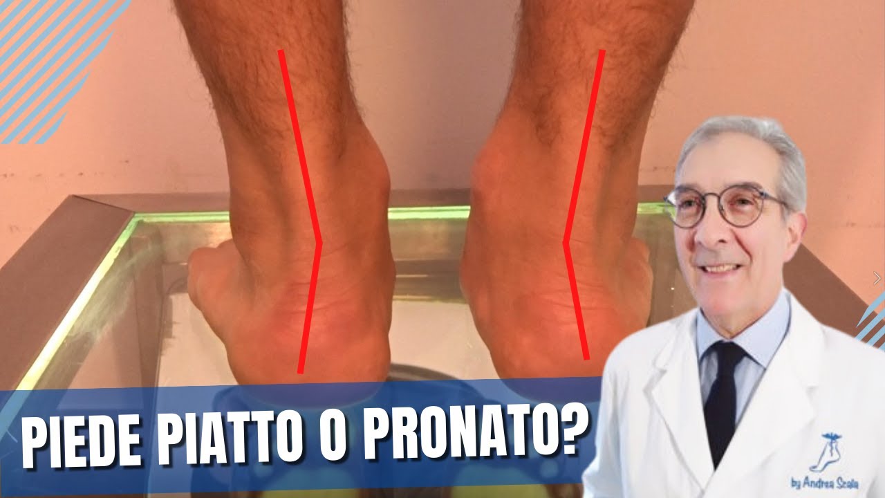 Piede pronato valgo: Il 