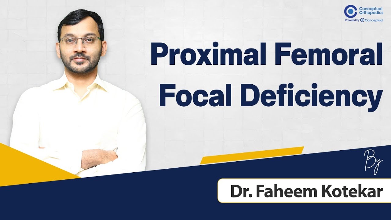 Understand Proximal Femoral Focal Deficiency (PFFD) with Dr. Faheem Kotekar | Orthopedics Residency