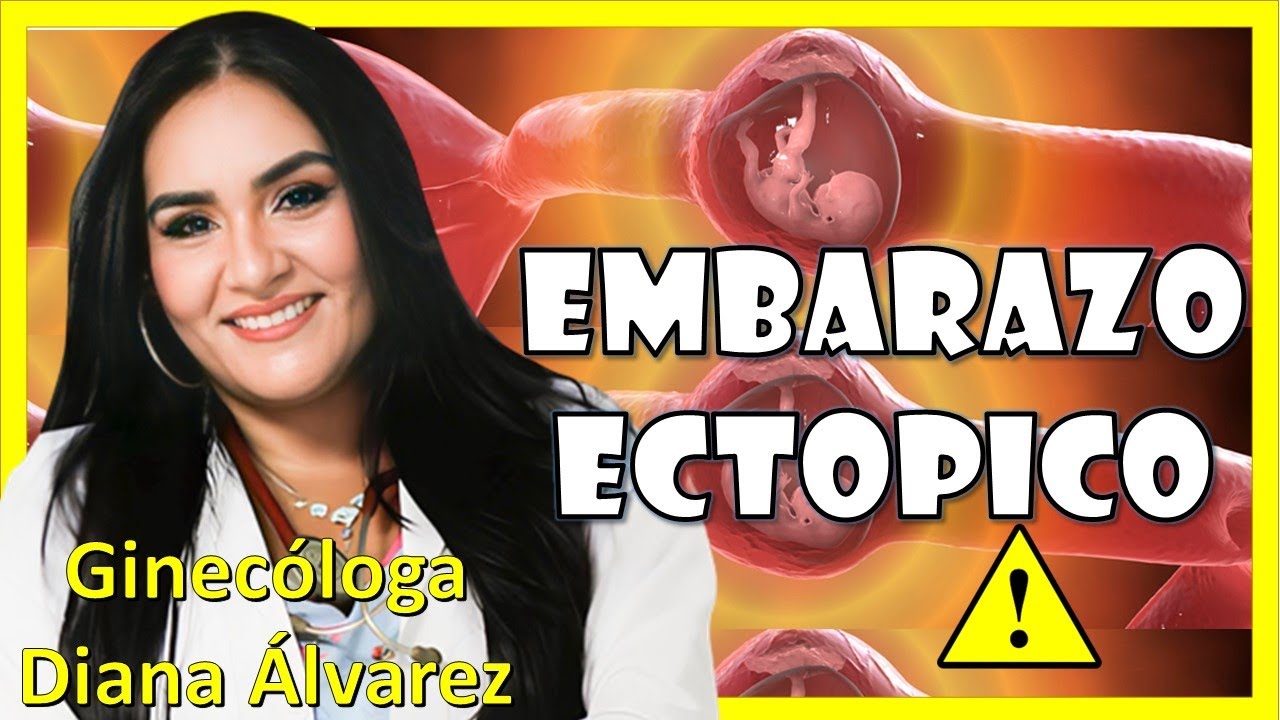 ACLARANDO TODAS las DUDAS sobre EMBARAZO ECTOPICO e HISTORIAS REALES 😱 por GINECOLOGA DIANA ALVAREZ
