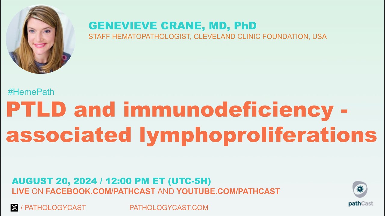 #HEMEPATH PTLD and immunodeficiency- associated lymphoproliferations
