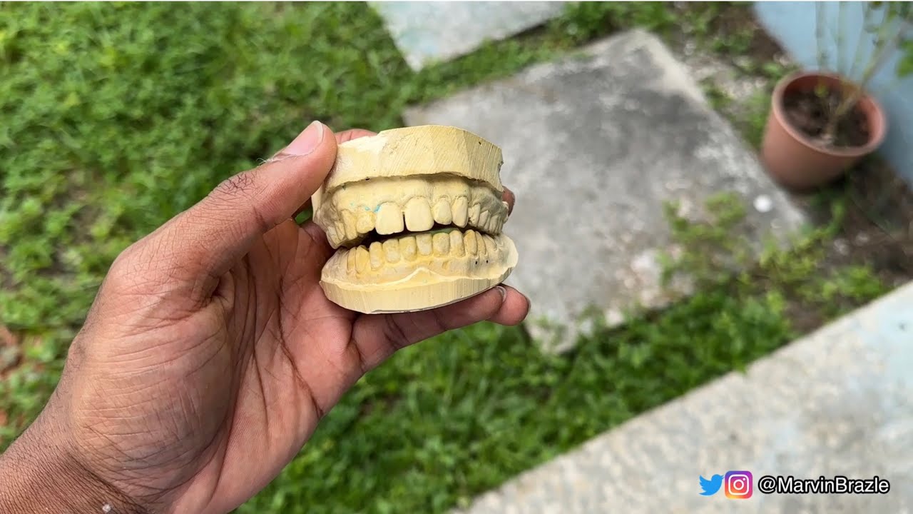 How to make a mold of your teeth (grillz dental impression)