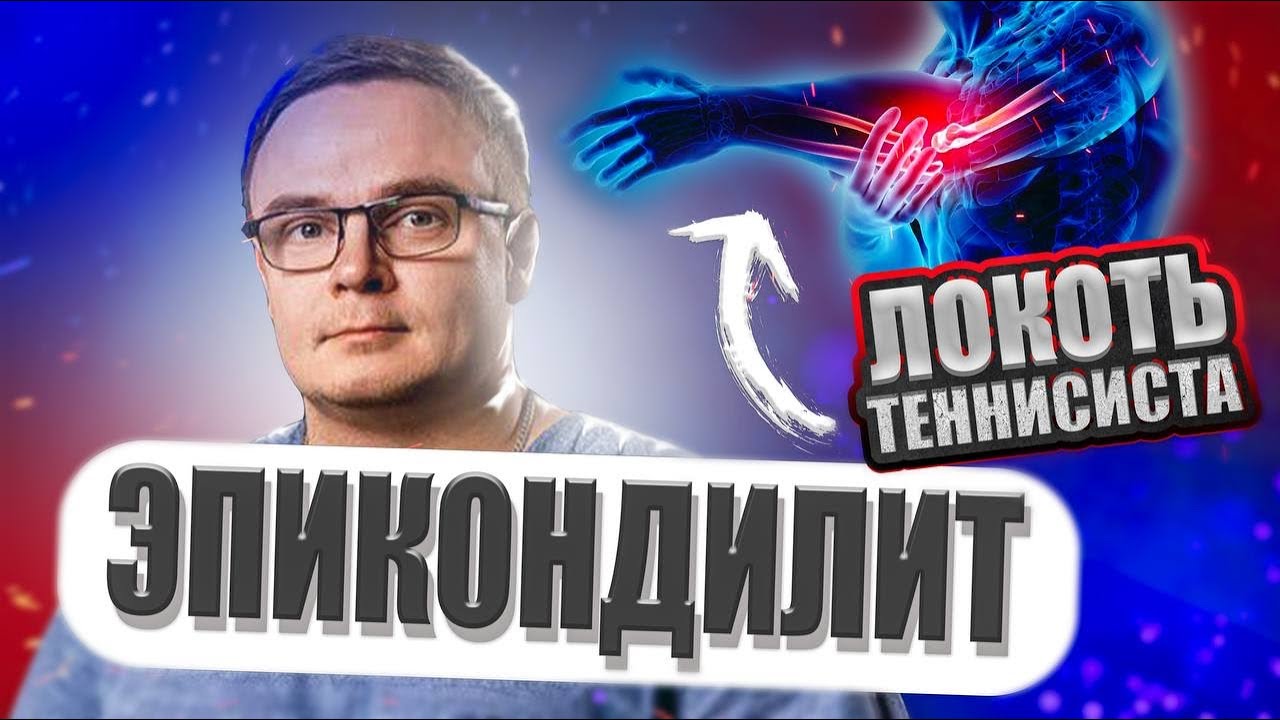 ЭПИКОНДИЛИТ | Почему Болит Локоть