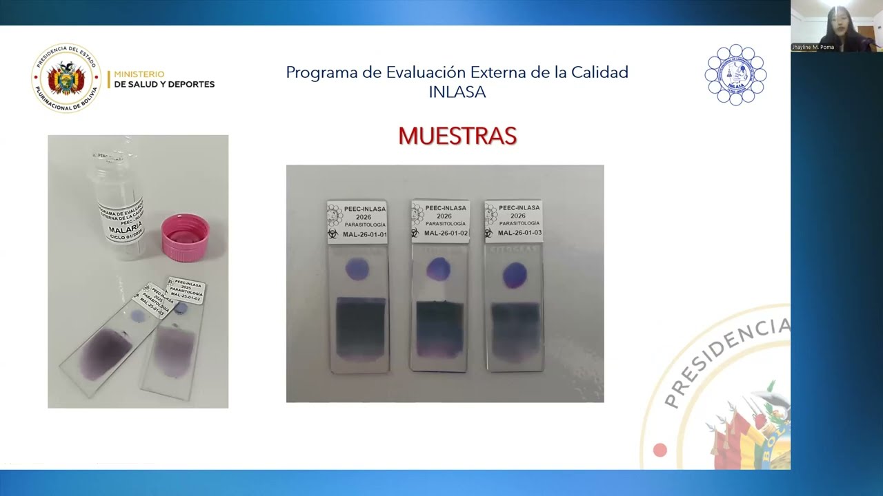 REUNION APERTURA MALARIA-LEISHMANIASIS-TOXOPLASMOSIS