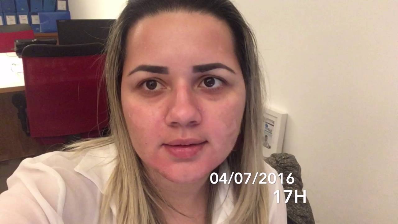 VLOG: Peeling Rose de Mer - Mar morto - Antes, durante e depois - SkinGrace - Pico das Divas
