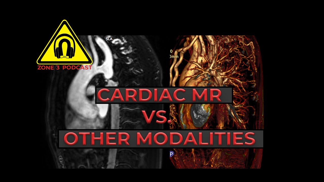Z3P Clips: Cardiac MRI vs Other Modalities