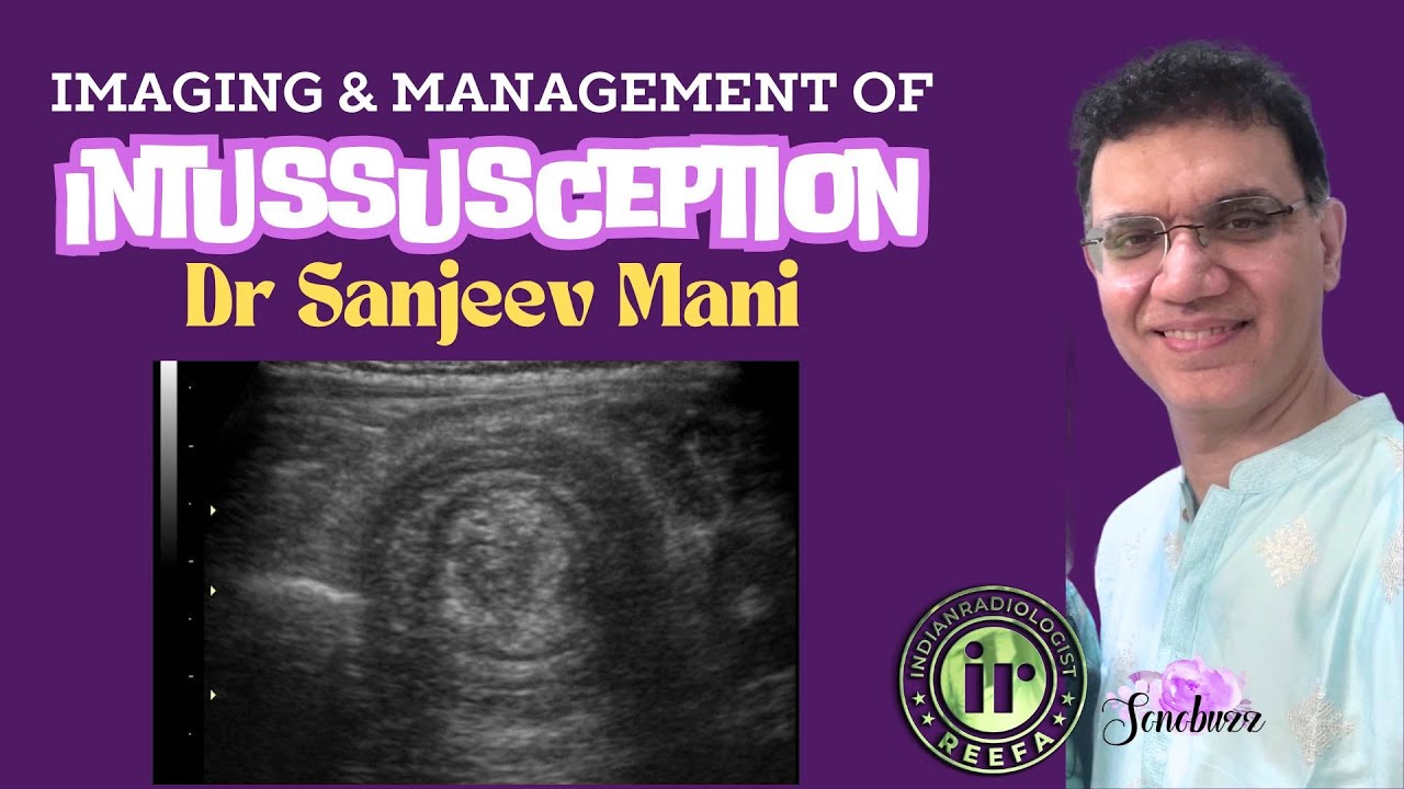 SANJEEV MANI | Intussusception