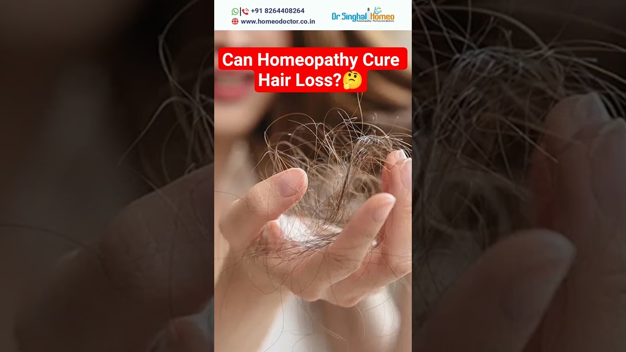 Can Homeopathy Cure Hair Loss & Dandruff? 🤔 | Dr. Vikas Singhal🧑&zwj;⚕️#hairproblem #hairfallsolution